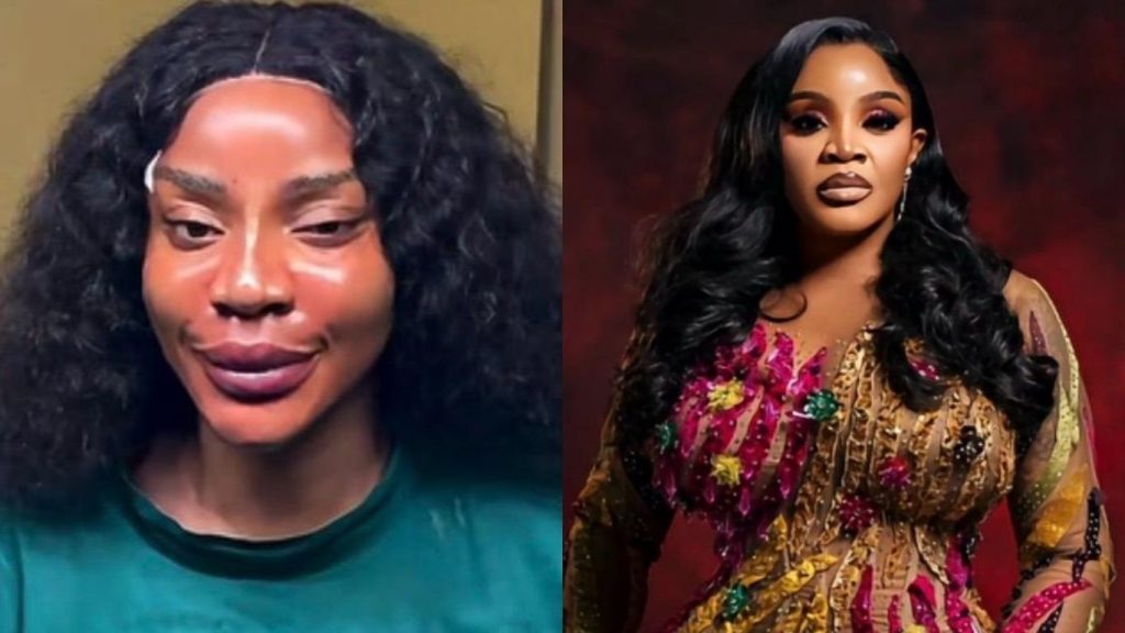 Actress Uche Ogbodo Flaunts New Face After Undergoing Cosmetic Procedure Uche Ogbodo-cosmetic