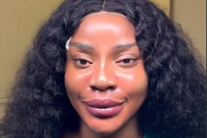 Why I’m Unhappy With My New Look After Facial Procedure — Actress Uche Ogbodo
