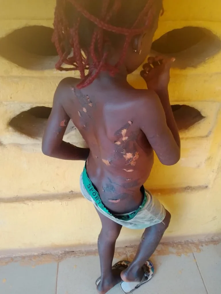 Mother arrested for allegedly burning daughter with hot knife
